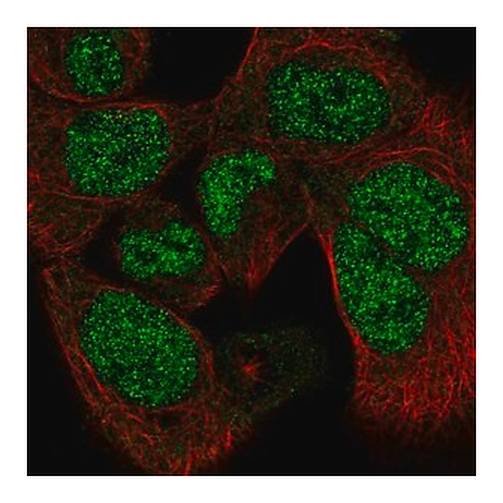 Merck Anti-PAPLN antibody produced in rabbit