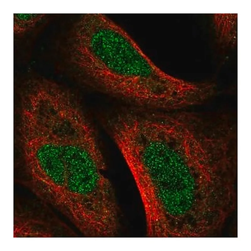 Merck Anti-UVSSA antibody produced in rabbit