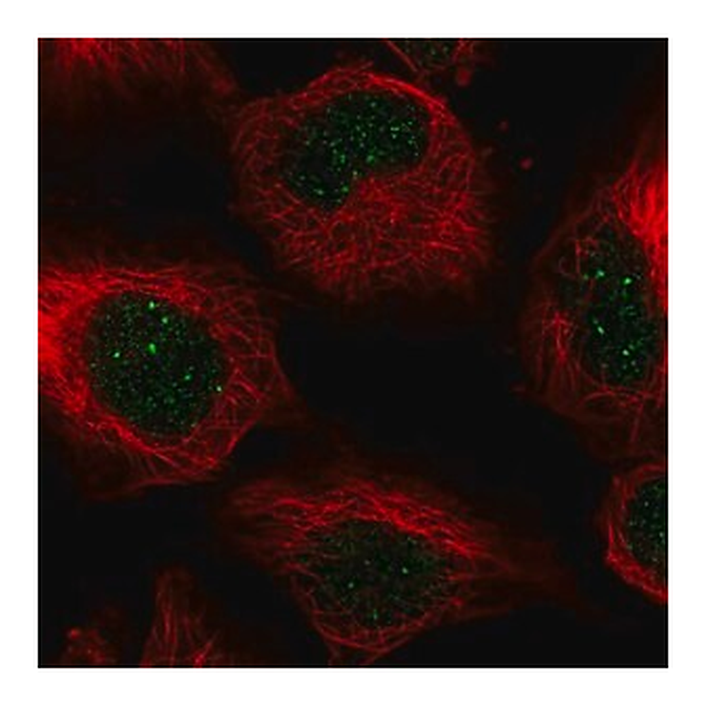 Merck Anti-CENPB antibody produced in rabbit