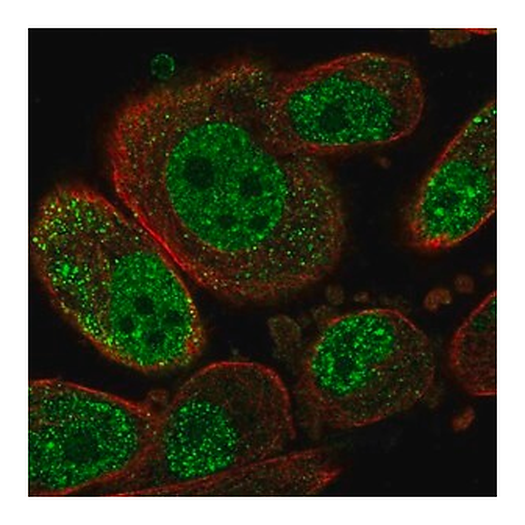 Merck Anti-SETD6 antibody produced in rabbit