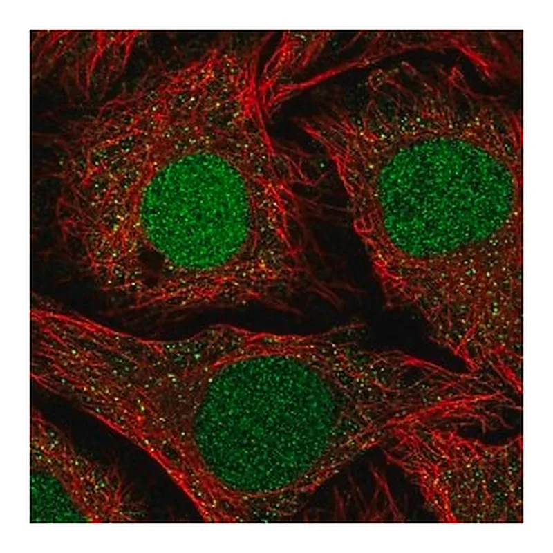 Merck Anti-NFATC2IP antibody produced in rabbit