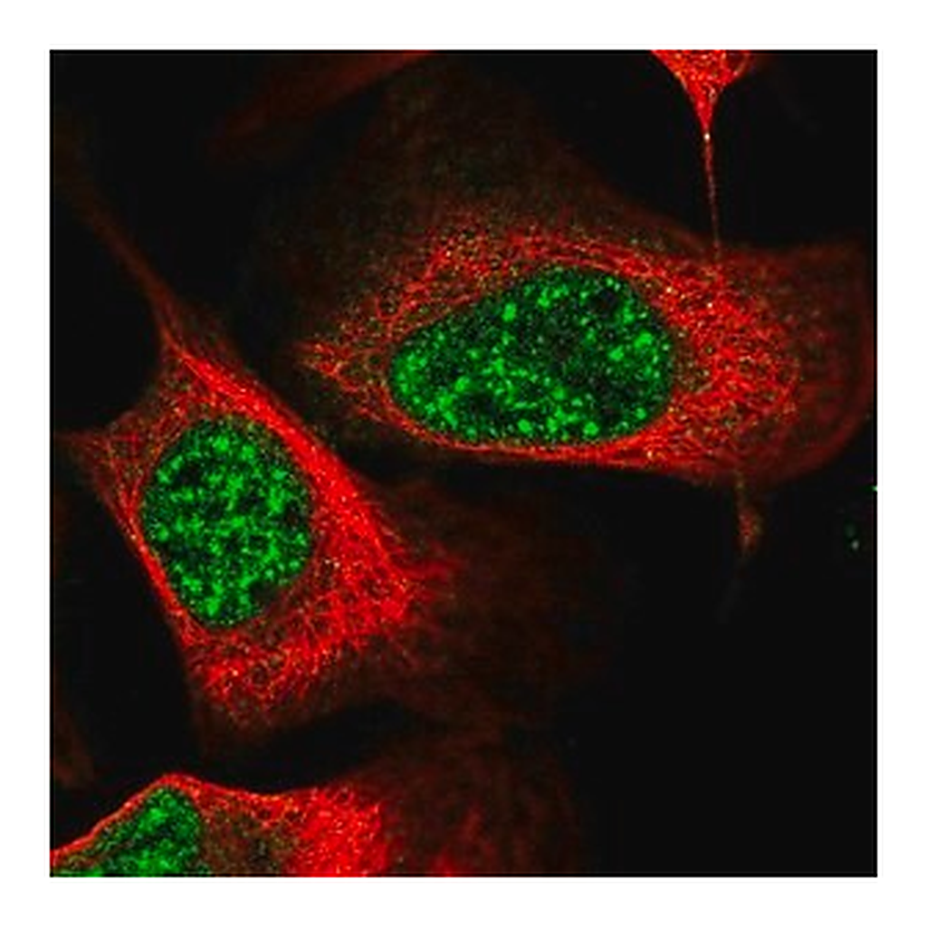 Merck Anti-EEPD1 antibody produced in rabbit