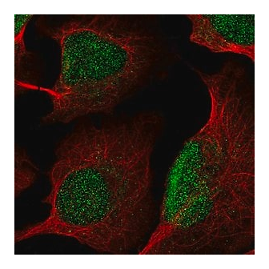 Merck Anti-KDM5B antibody produced in rabbit