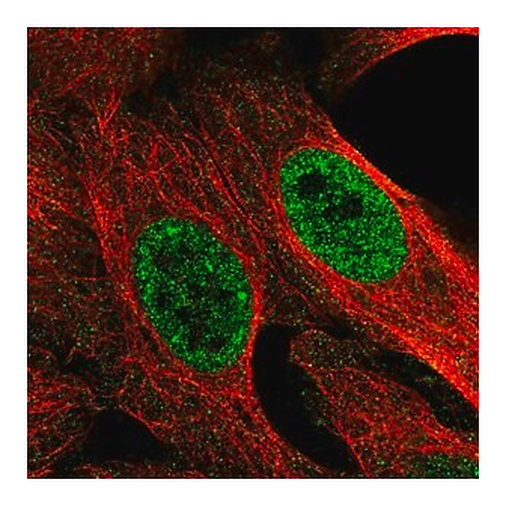 Merck Anti-MED22 antibody produced in rabbit