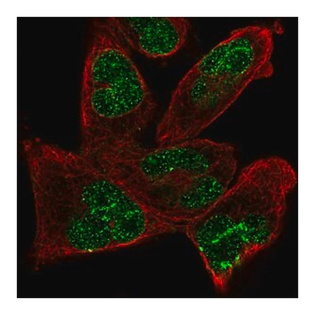 Merck Anti-ANKRD17 antibody produced in rabbit