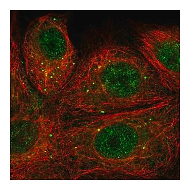 Merck Anti-SEMA3E antibody produced in rabbit