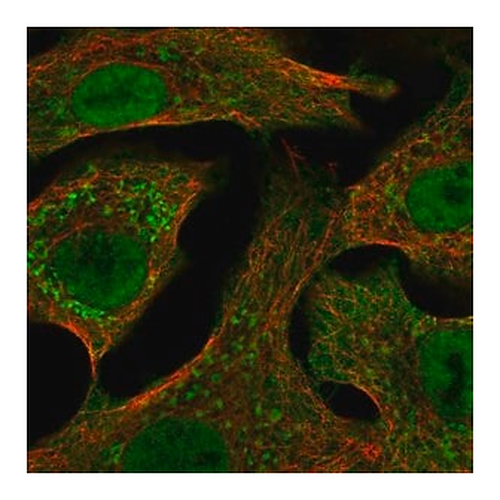 Merck Anti-CYP24A1 antibody produced in rabbit