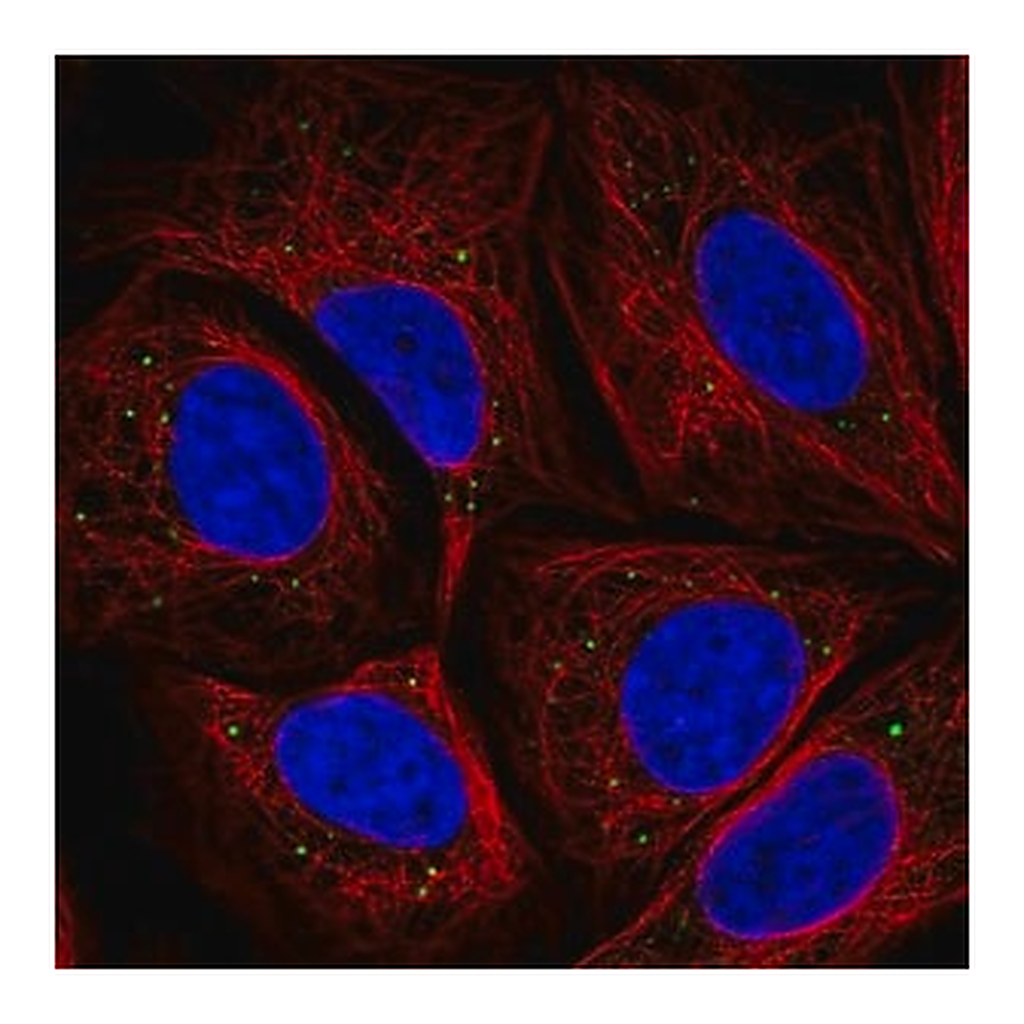 Merck Anti-HTRA3 antibody produced in rabbit