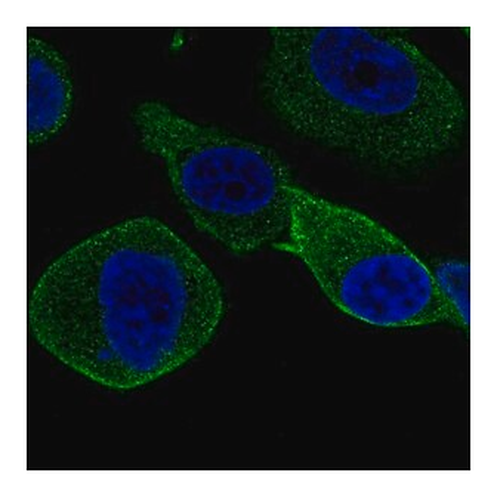 Merck Anti-STXBP2 antibody produced in rabbit