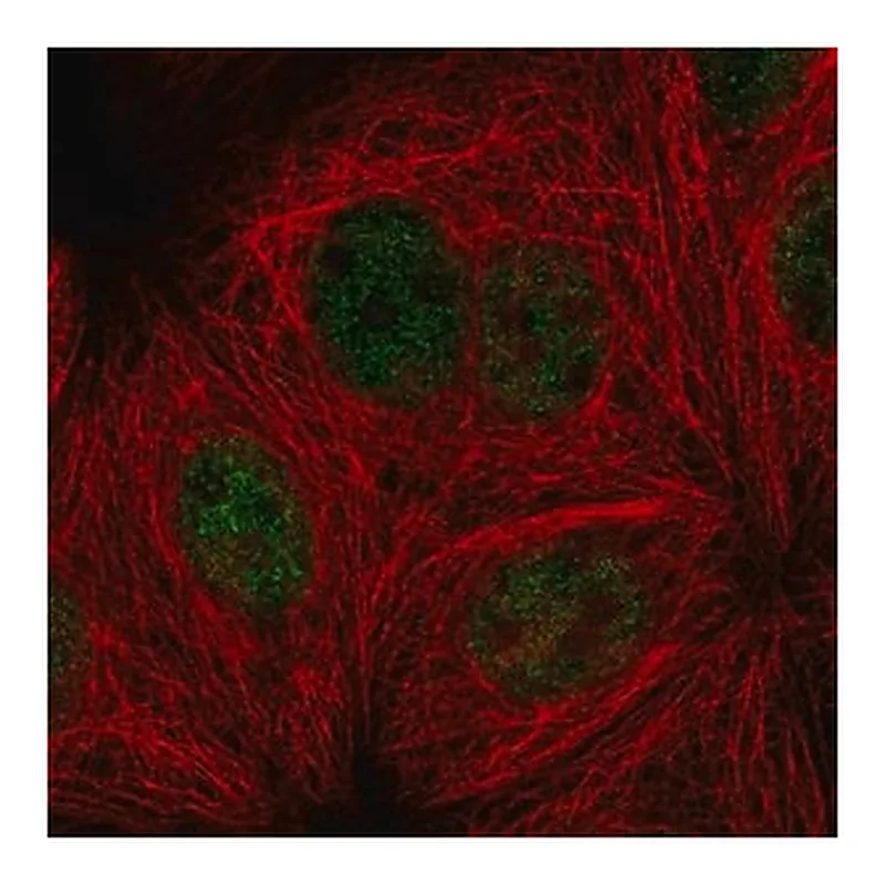 Merck Anti-PPP4R3A antibody produced in rabbit