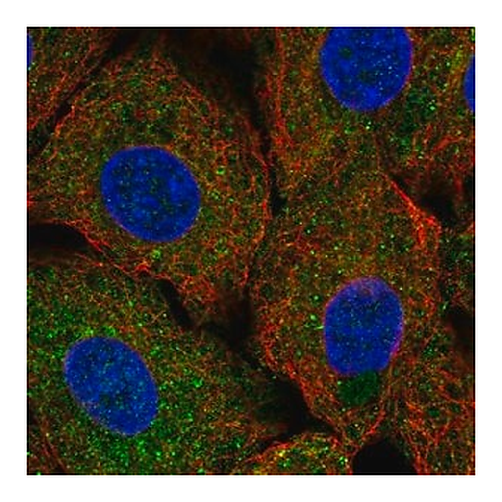 Merck Anti-ULK1 antibody produced in rabbit