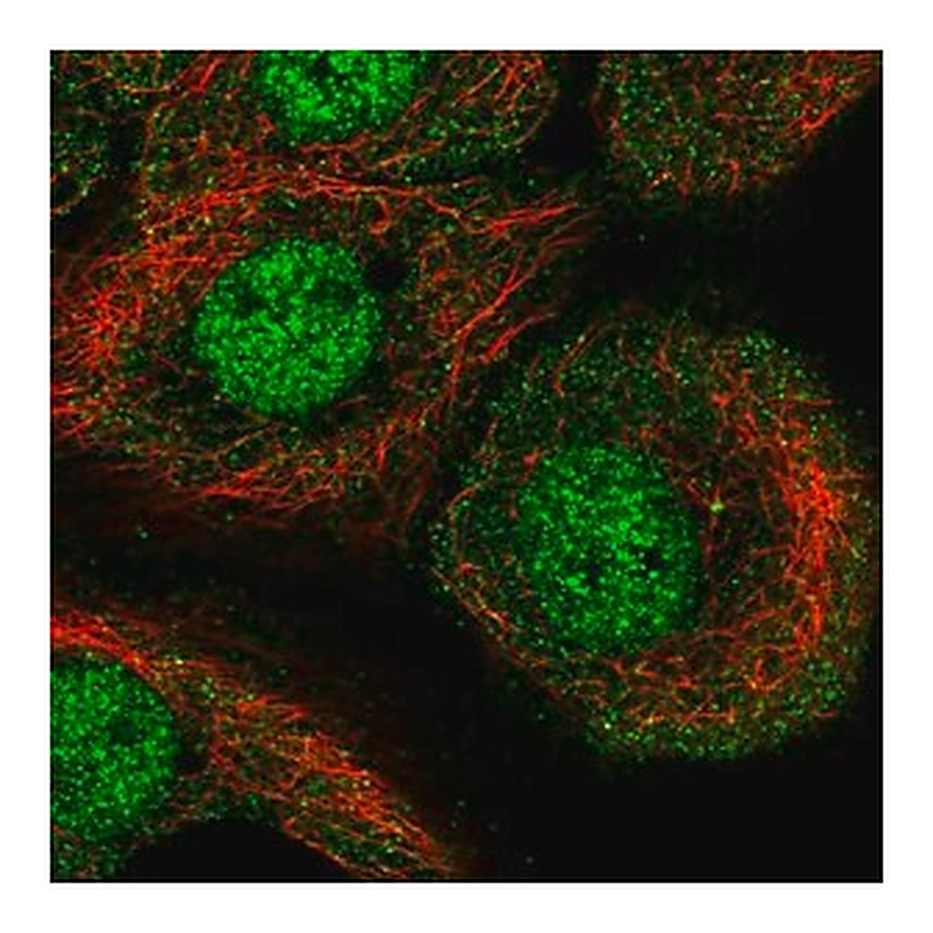 Merck Anti-AKNA antibody produced in rabbit