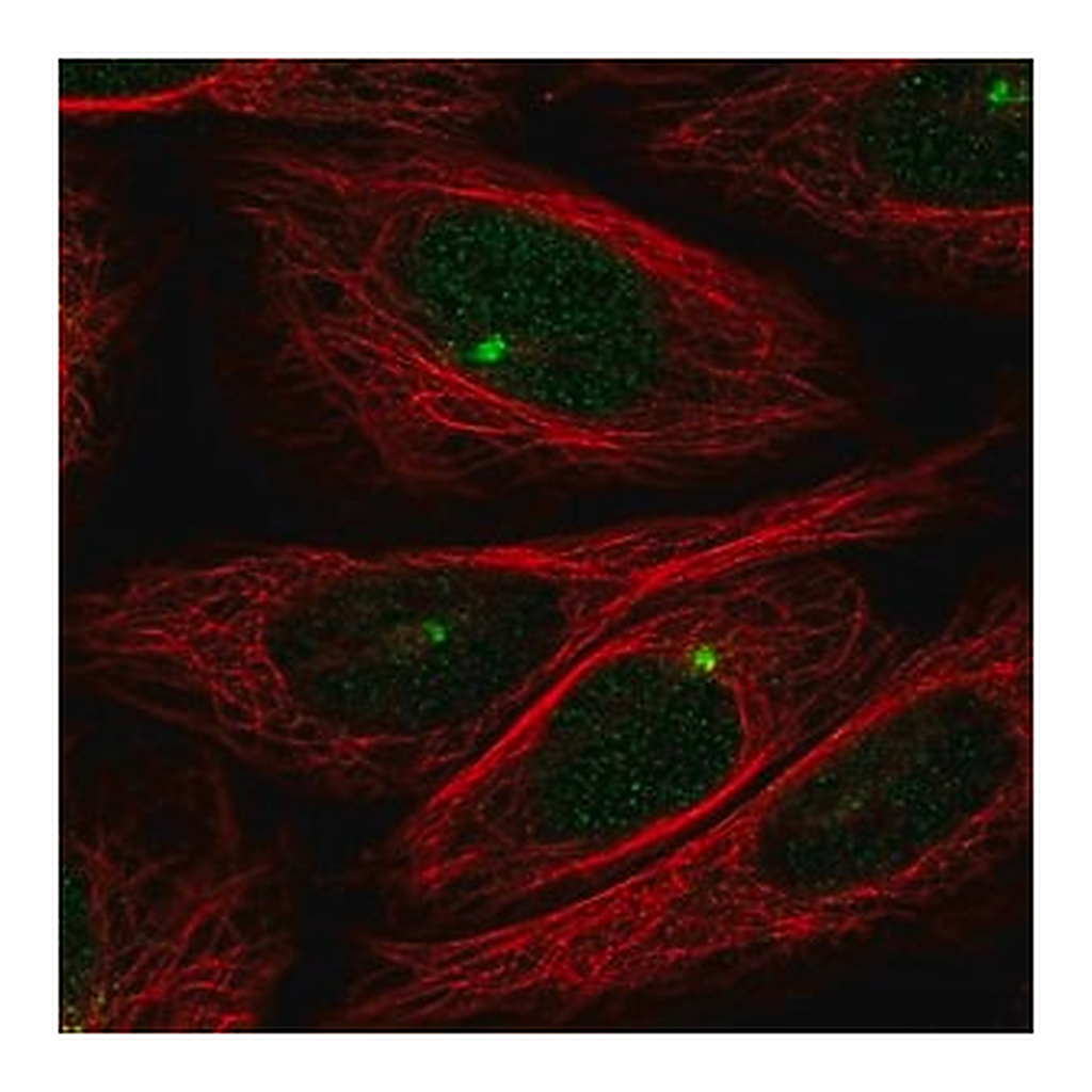 Merck Anti-ZMYM1 antibody produced in rabbit