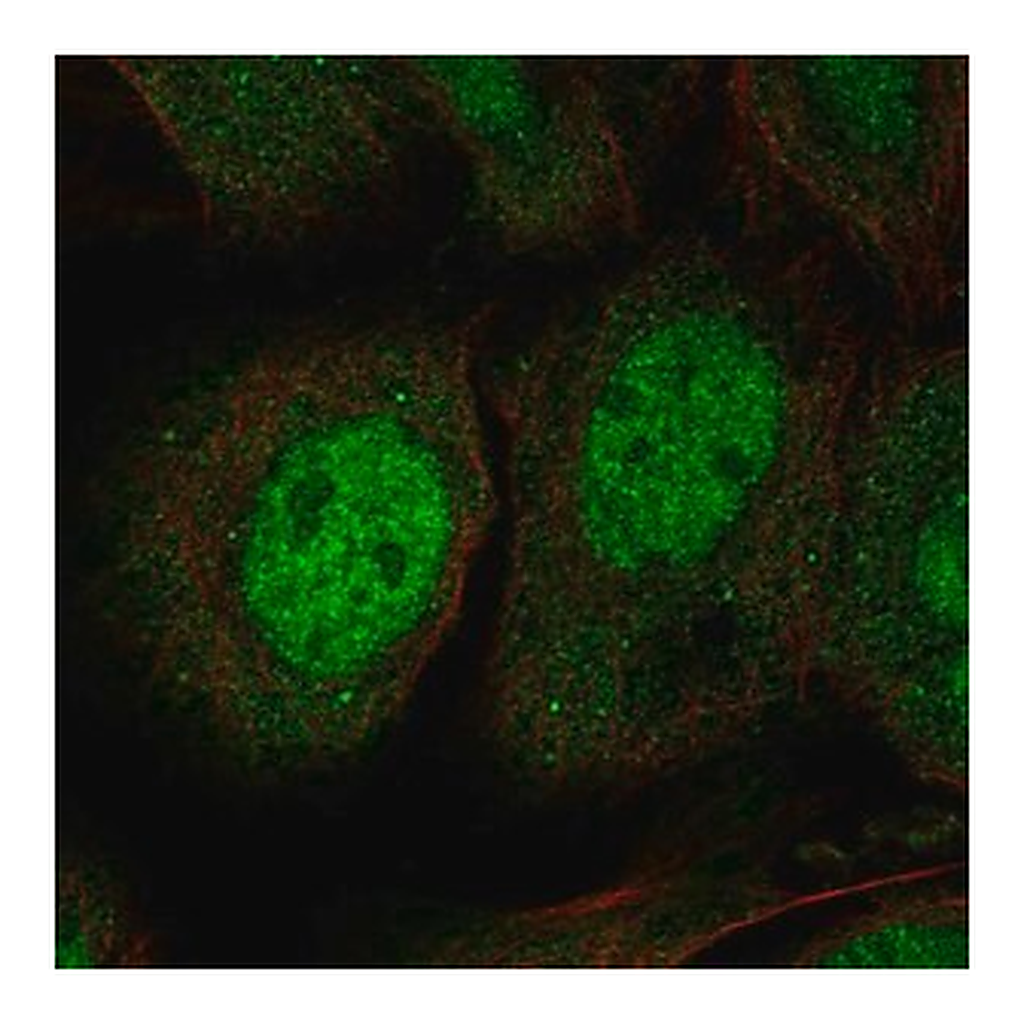 Merck Anti-JPH3 antibody produced in rabbit