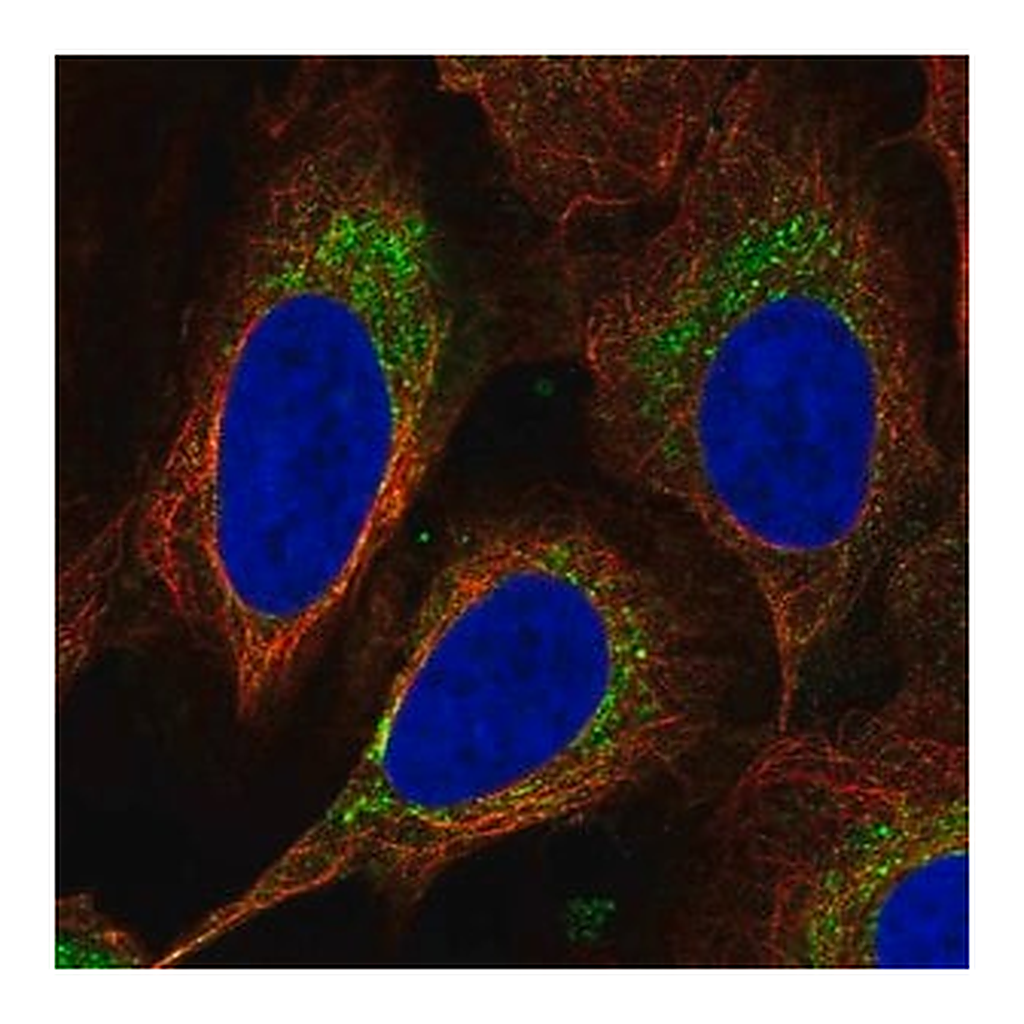 Merck Anti-DEGS1 antibody produced in rabbit
