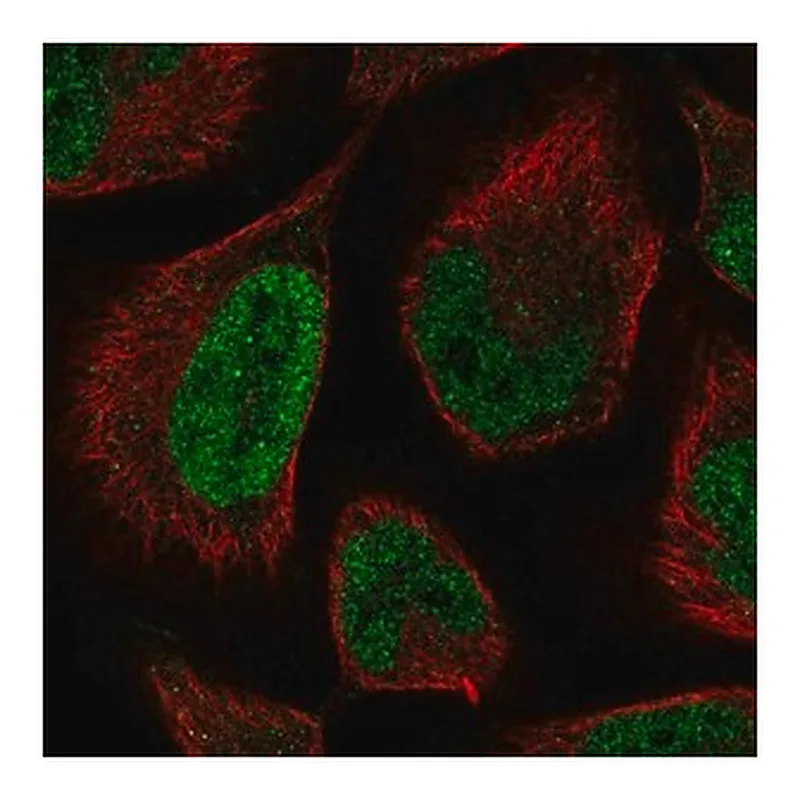 Merck Anti-LCOR antibody produced in rabbit
