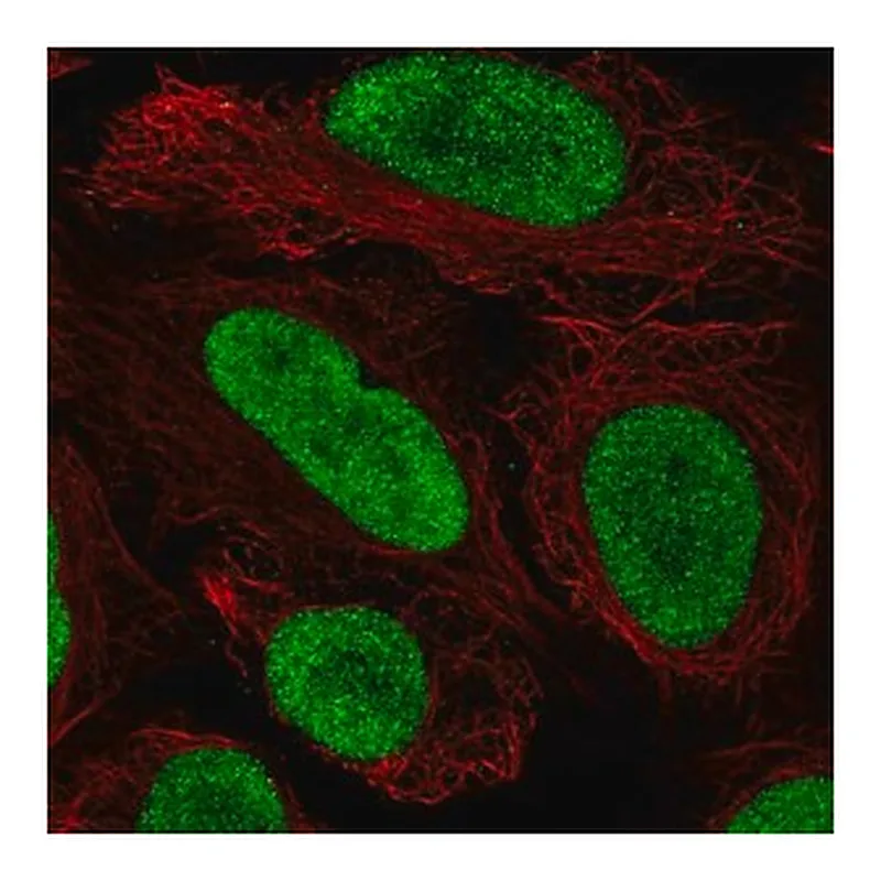 Merck Anti-HMGN2 antibody produced in rabbit