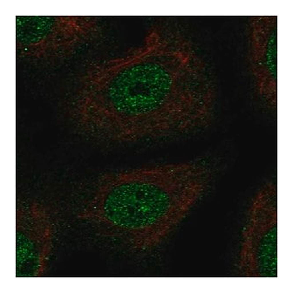 Merck Anti-TSC22D1 antibody produced in rabbit