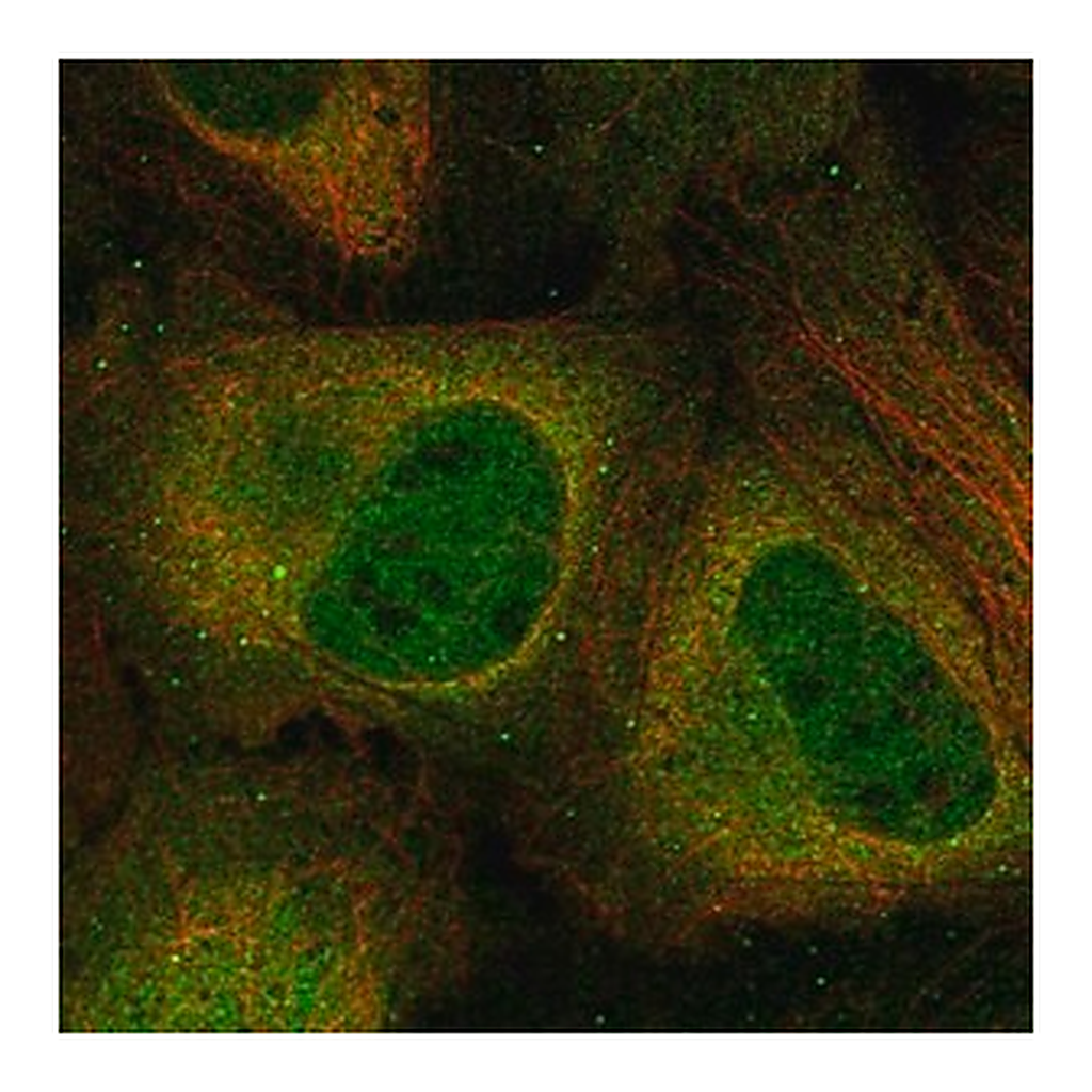 Merck Anti-CSNK2A2 antibody produced in rabbit