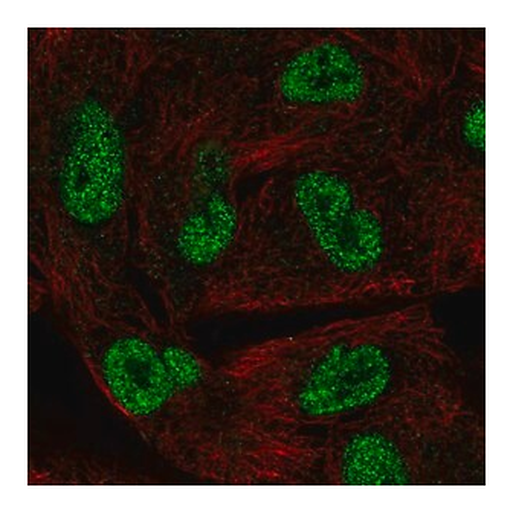Merck Anti-HORMAD1 antibody produced in rabbit