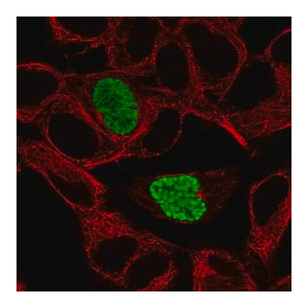 Merck Anti-DYRK1B antibody produced in rabbit