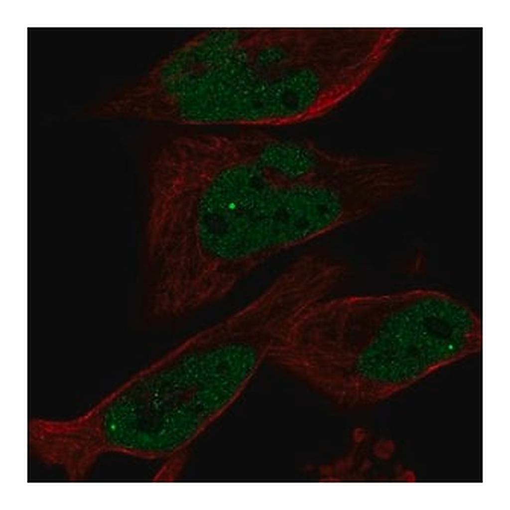 Merck Anti-EYA1 antibody produced in rabbit