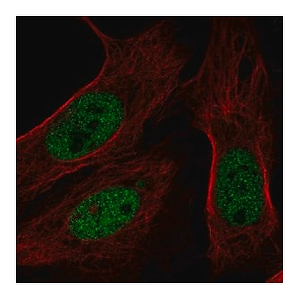 Merck Anti-BAP1 antibody produced in rabbit