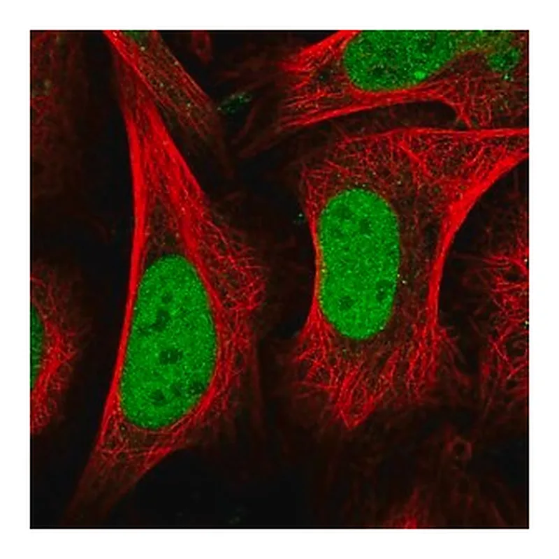 Merck Anti-CENPQ antibody produced in rabbit