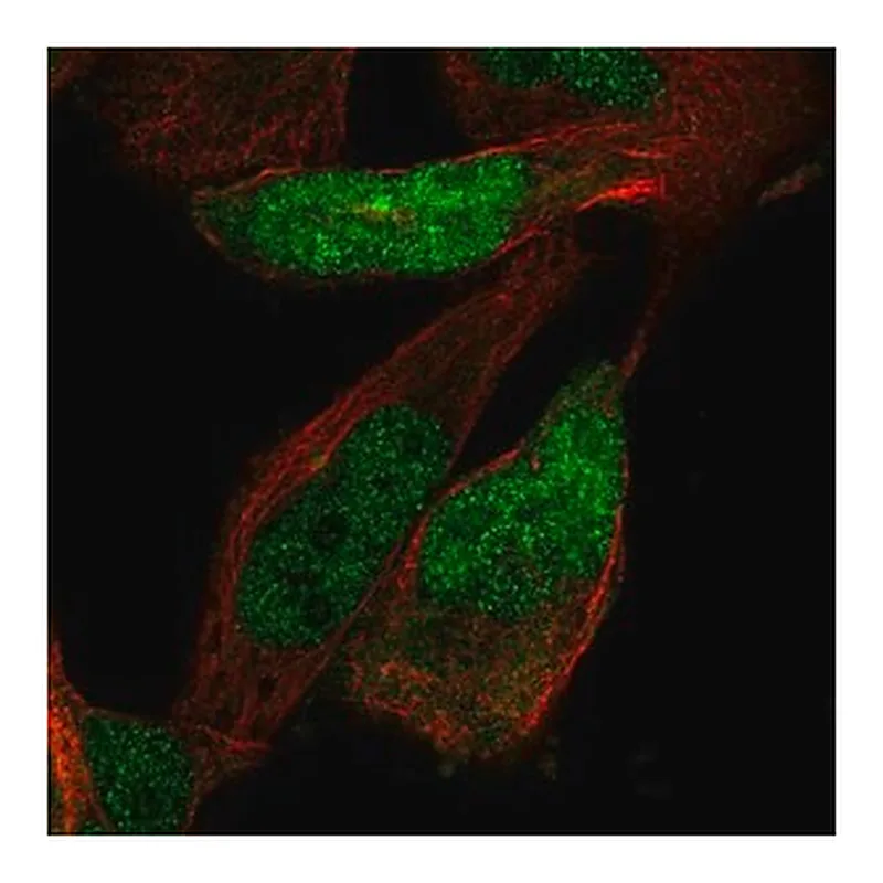 Merck Anti-ZNF518A antibody produced in rabbit