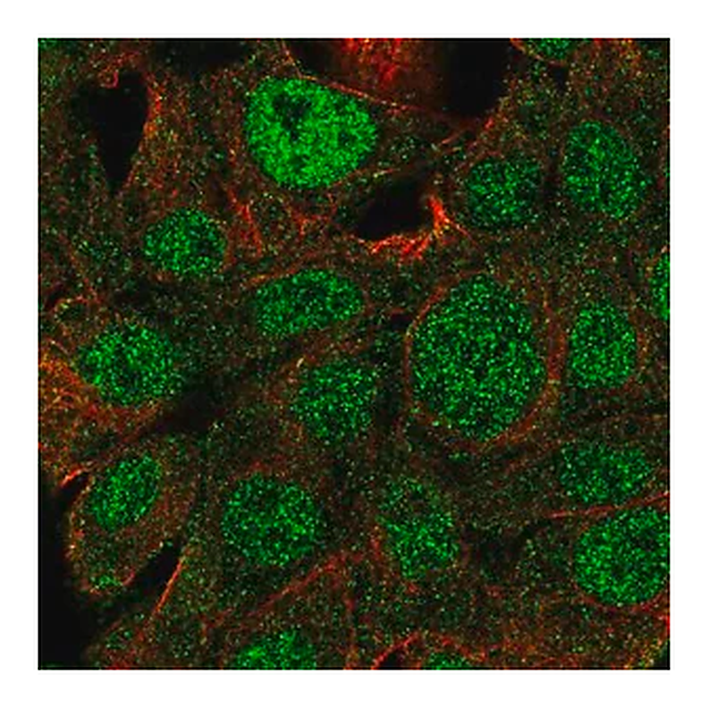 Merck Anti-SLC2A2 antibody produced in rabbit