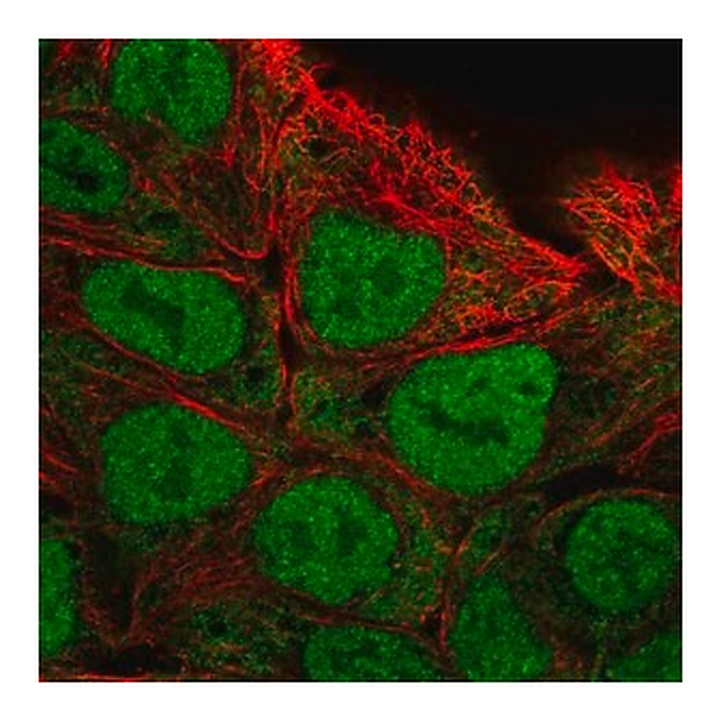 Merck Anti-CAPN13 antibody produced in rabbit