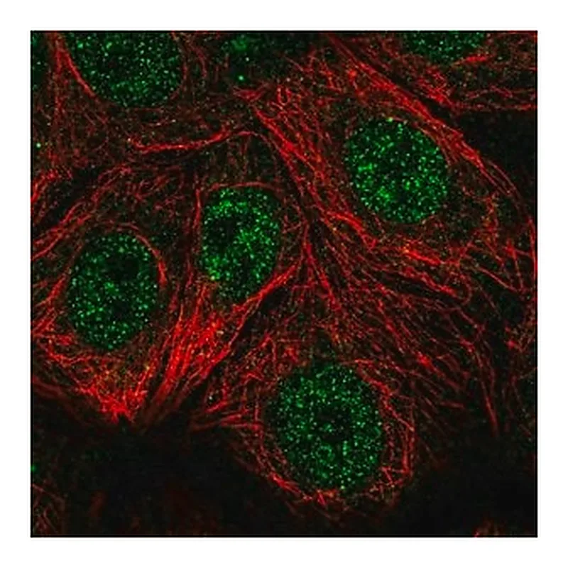 Merck Anti-TSPAN17 antibody produced in rabbit