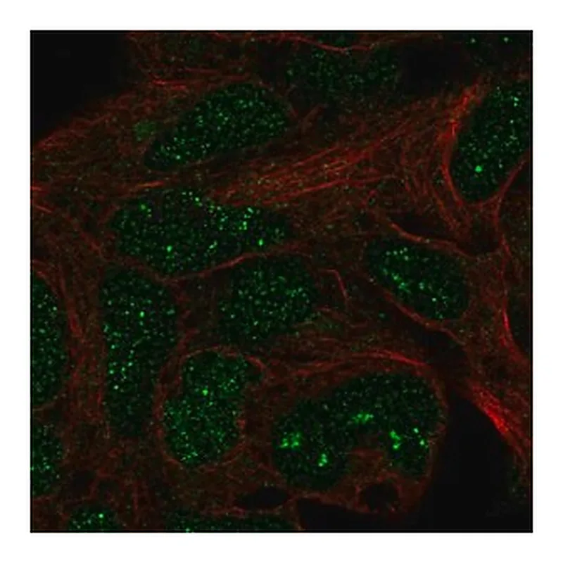Merck Anti-TRMT11 antibody produced in rabbit