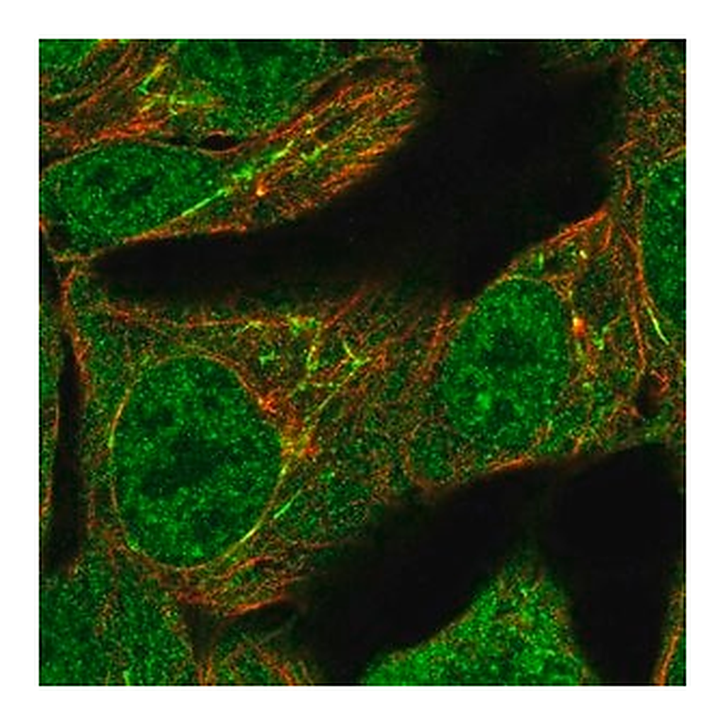 Merck Anti-TNFAIP2 antibody produced in rabbit