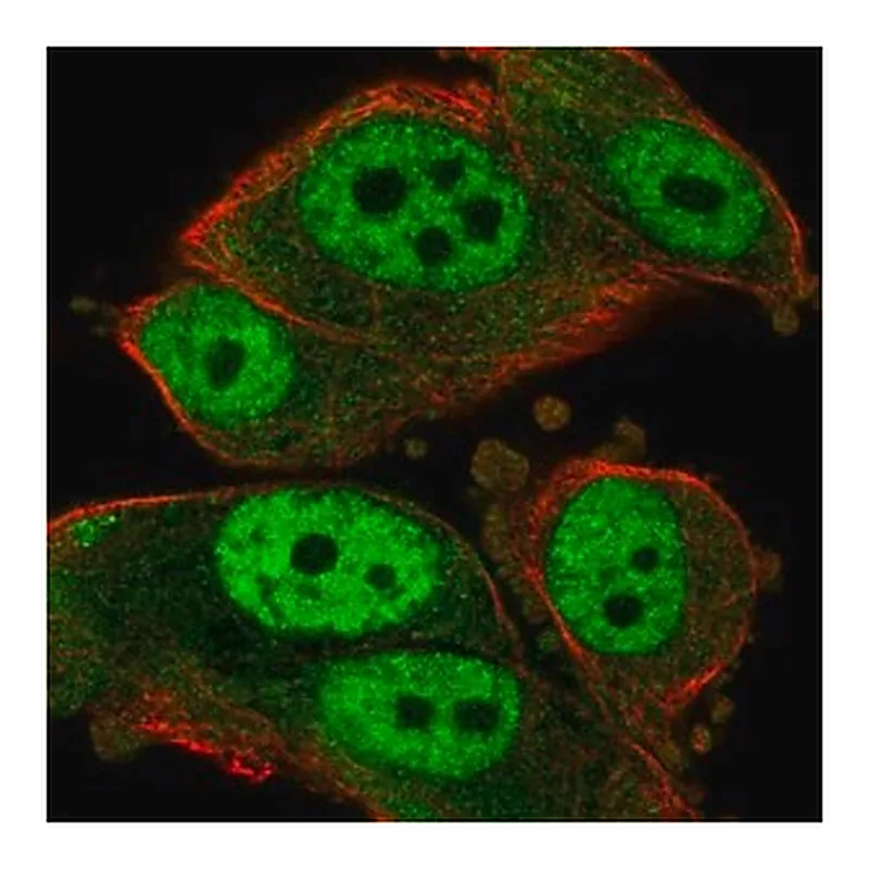 Merck Anti-RAD23A antibody produced in rabbit