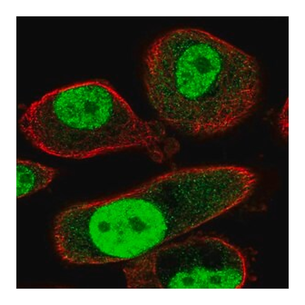 Merck Anti-TMEM184A antibody produced in rabbit