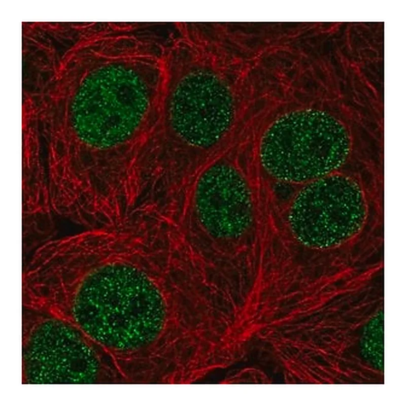 Merck Anti-TTC5 antibody produced in rabbit
