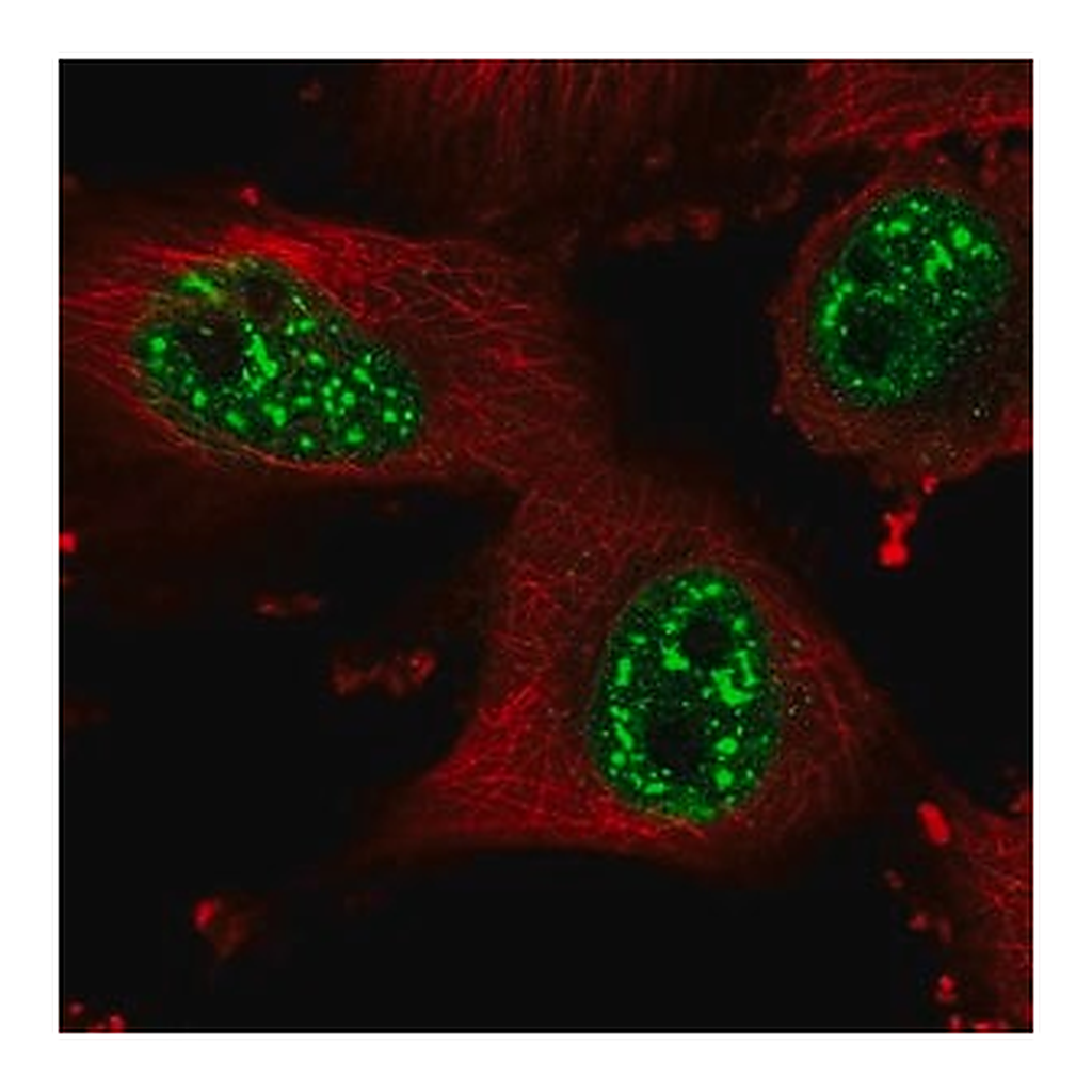 Merck Anti-HP1BP3 antibody produced in rabbit