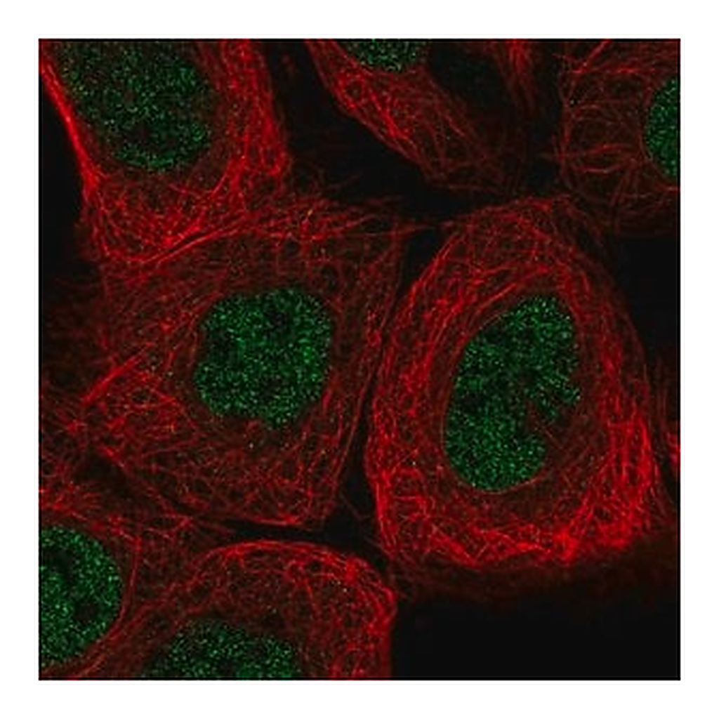 Merck Anti-AGL antibody produced in rabbit