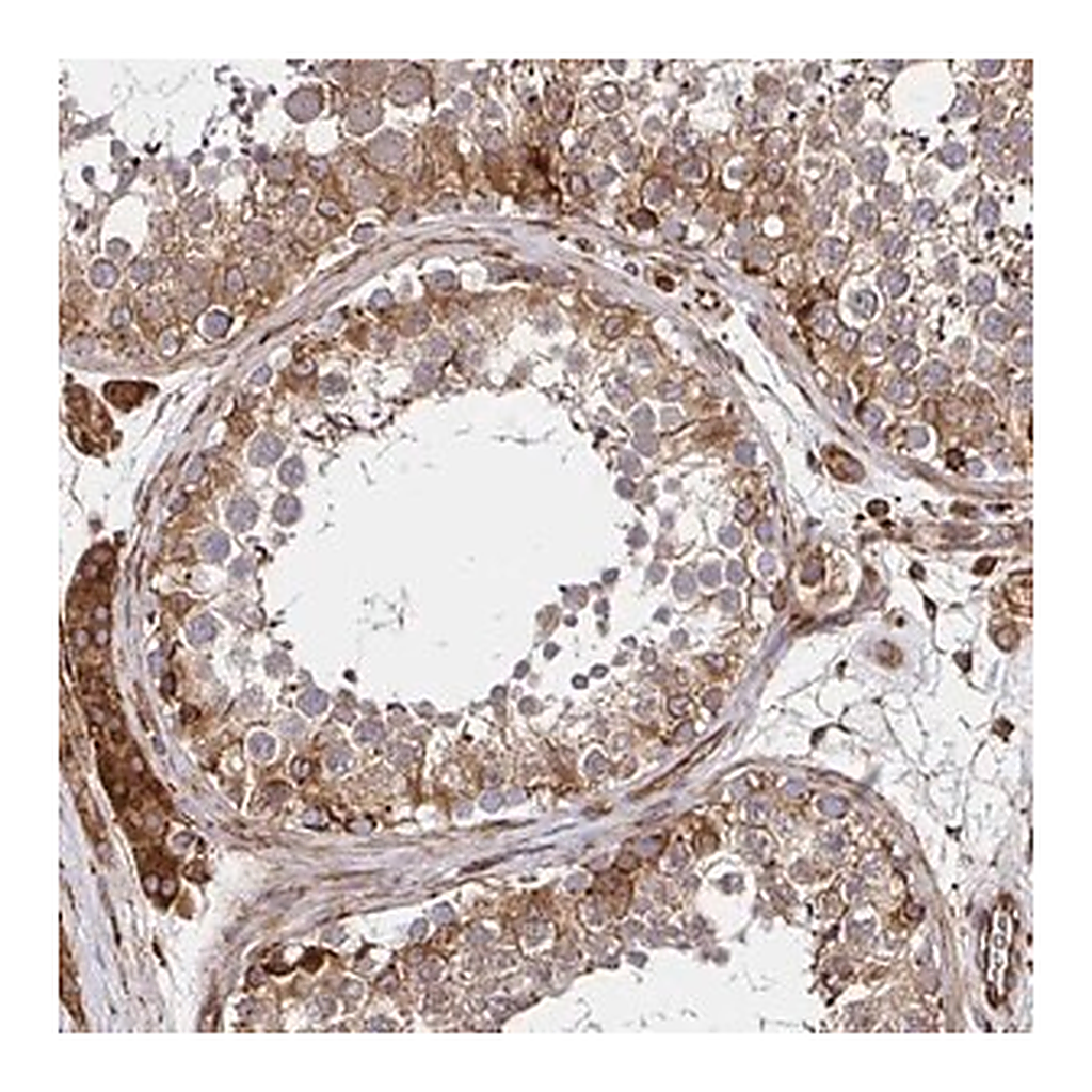 Merck Anti-SMYD3 antibody produced in rabbit