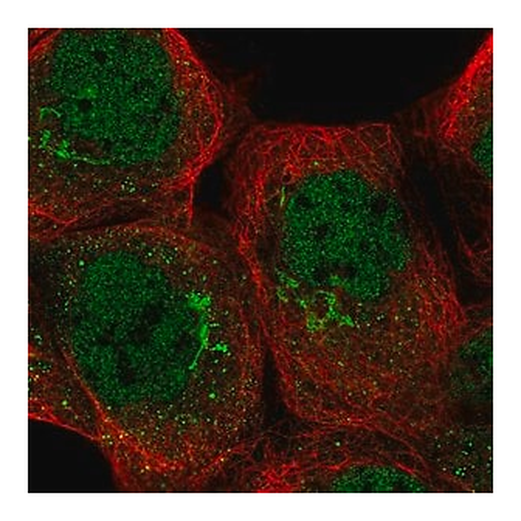 Merck Anti-TRRAP antibody produced in rabbit