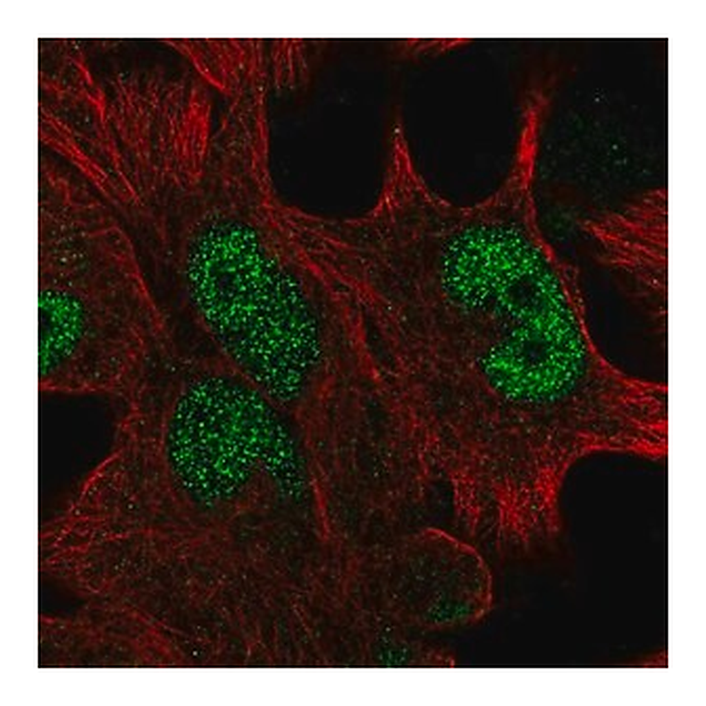Merck Anti-HOXD13 antibody produced in rabbit