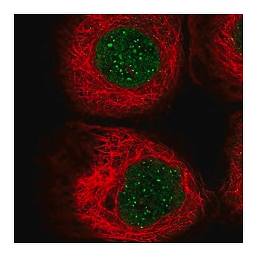 Merck Anti-CENPB antibody produced in rabbit