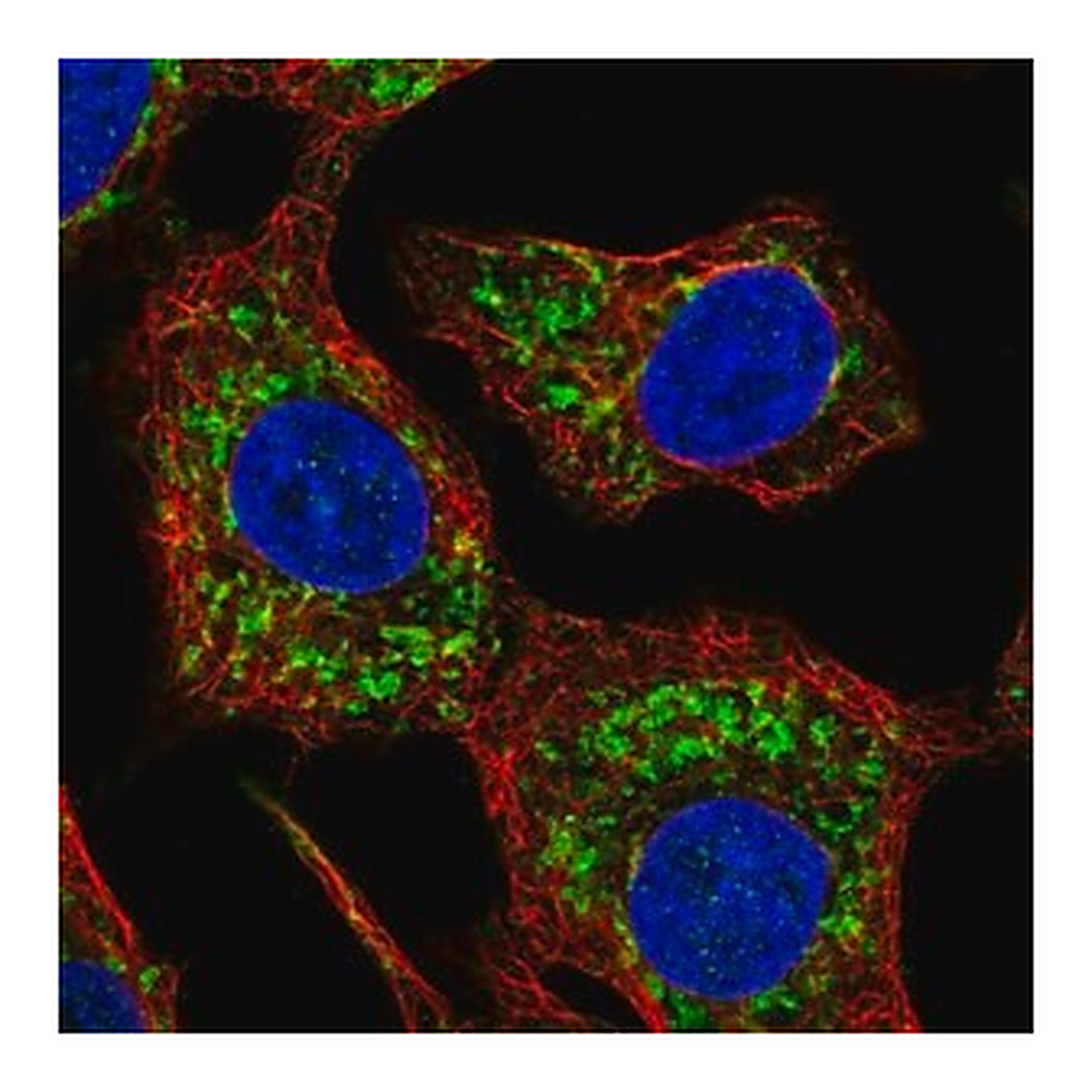 Merck Anti-HKDC1 antibody produced in rabbit