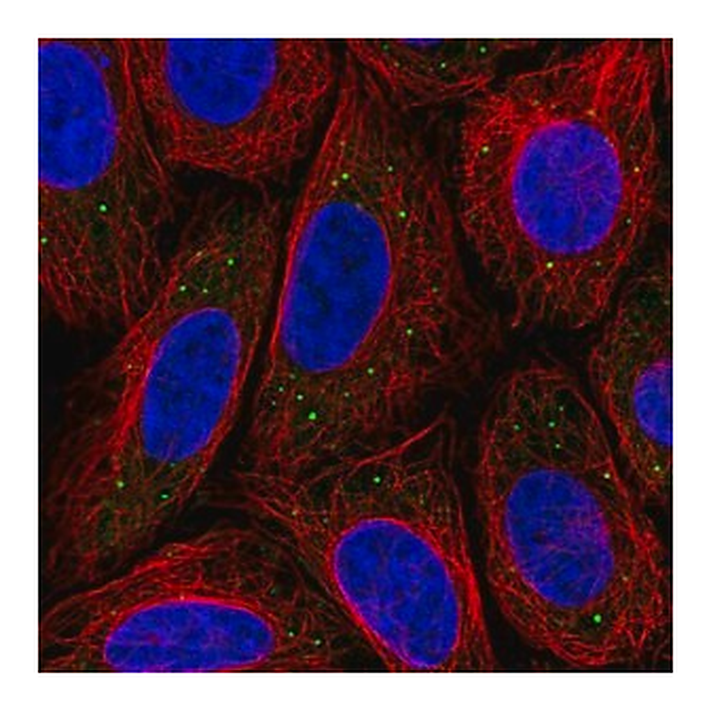 Merck Anti-MED17 antibody produced in rabbit