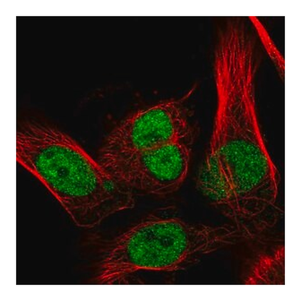 Merck Anti-RECQL antibody produced in rabbit