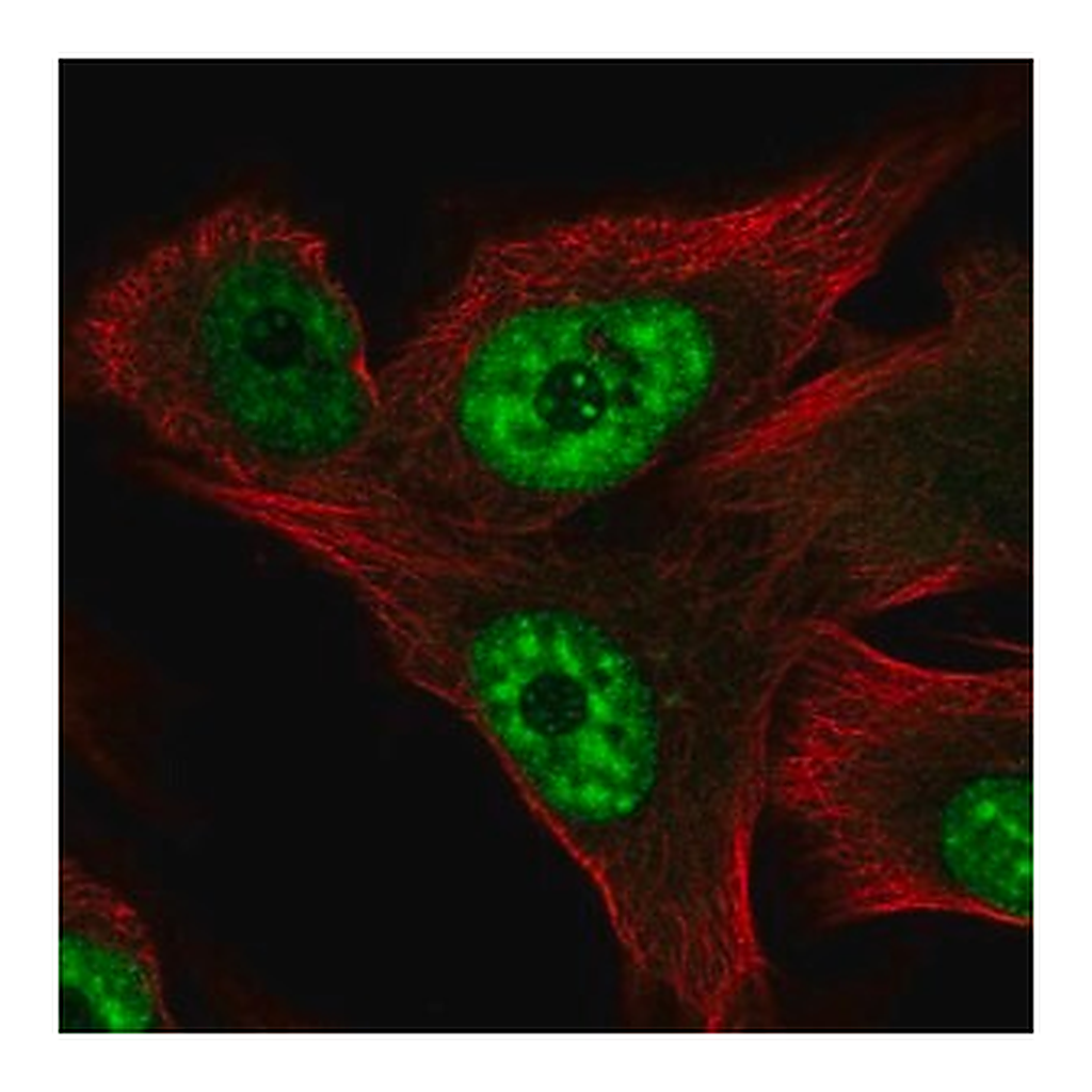 Merck Anti-RCAN3 antibody produced in rabbit