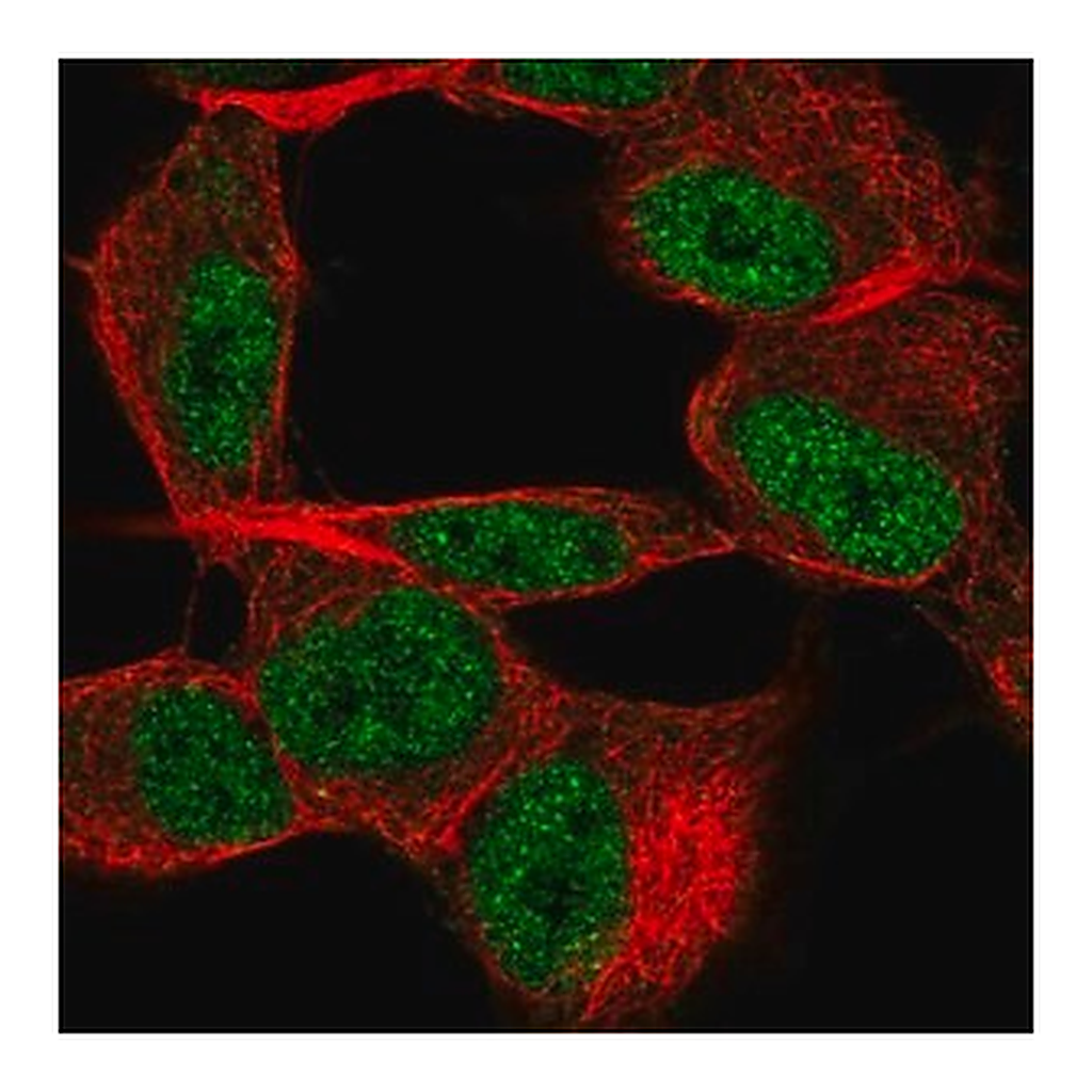 Merck Anti-TSTD2 antibody produced in rabbit