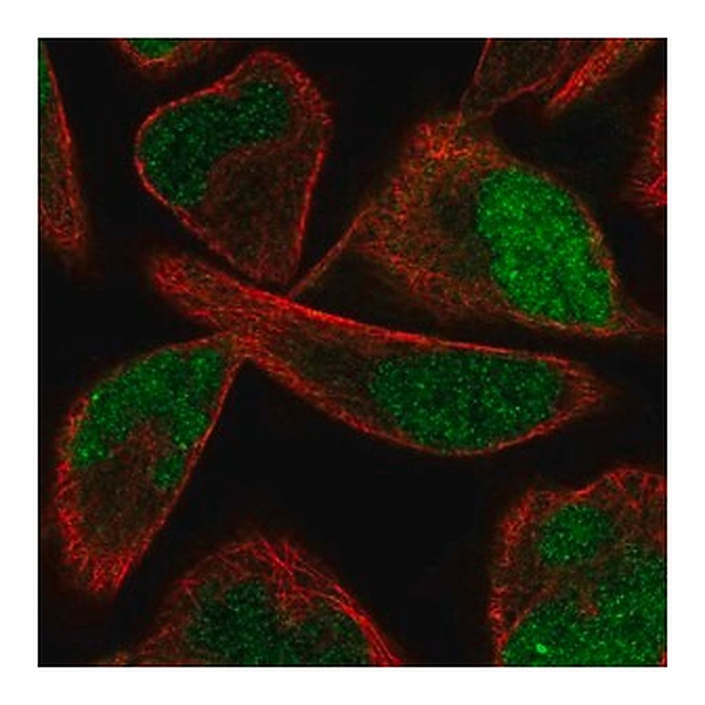 Merck Anti-PPME1 antibody produced in rabbit