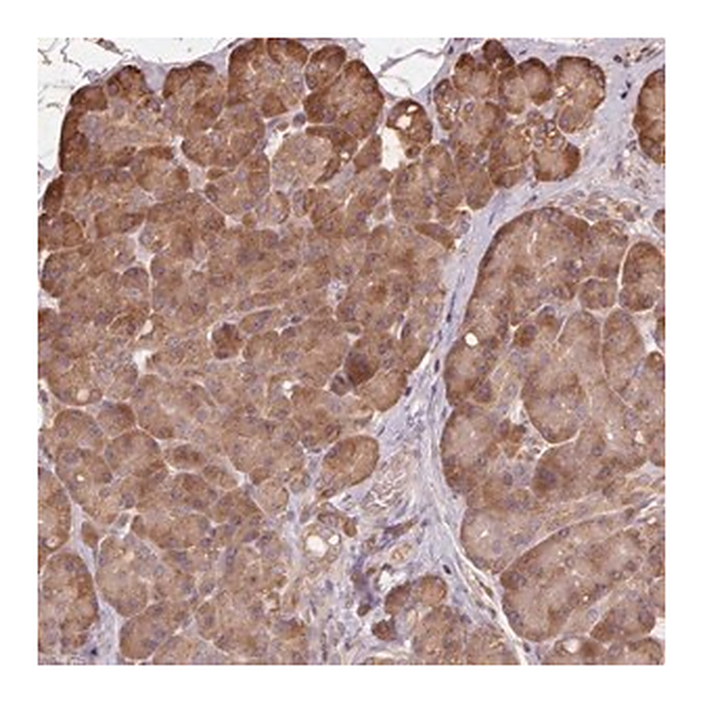 Merck Anti-MAP3K5 antibody produced in rabbit